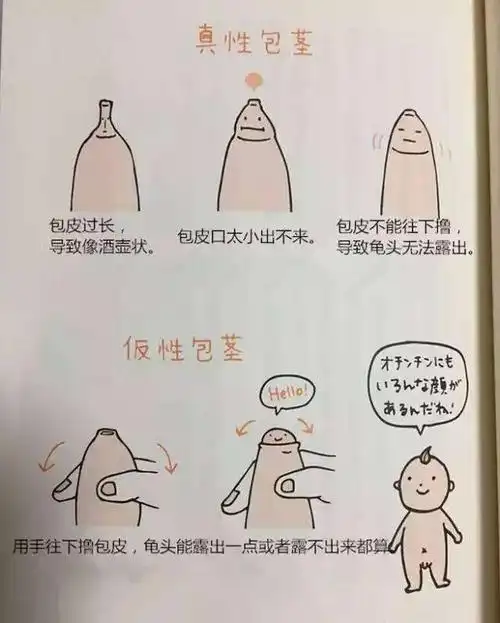 许多宝妈们在疑问为什么现在这么多孩子包茎呀?