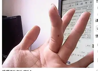 朋友问我他(男)右手中指 有颗黑色的痣是什么意思