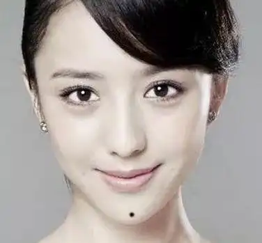 鼻子上面如果长有痣,那便是发财的象征,此类人天生聪明,有着不少赚钱