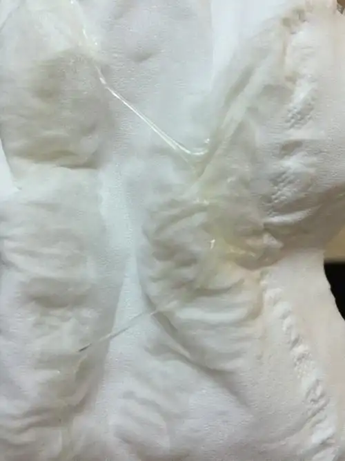 做血hcg检查男孩女孩目前的技术还未能准确预测的;排卵前期白带透明