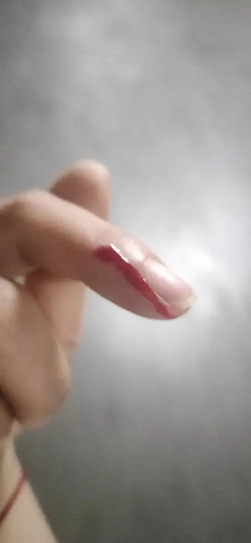 女人拒绝矫情流血的手拒上热搜