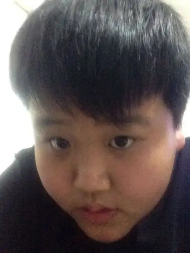 你们觉得这孩子很丑吗 我亲戚都说又丑有胖