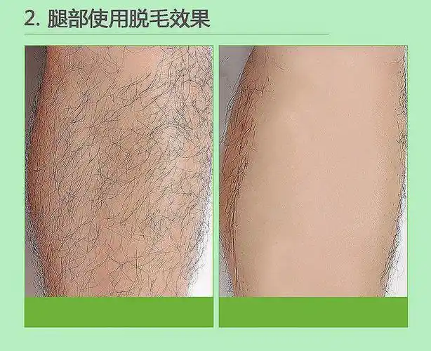 脱毛膏女去腋毛腿毛手臂去除腋下男脱毛喷雾
