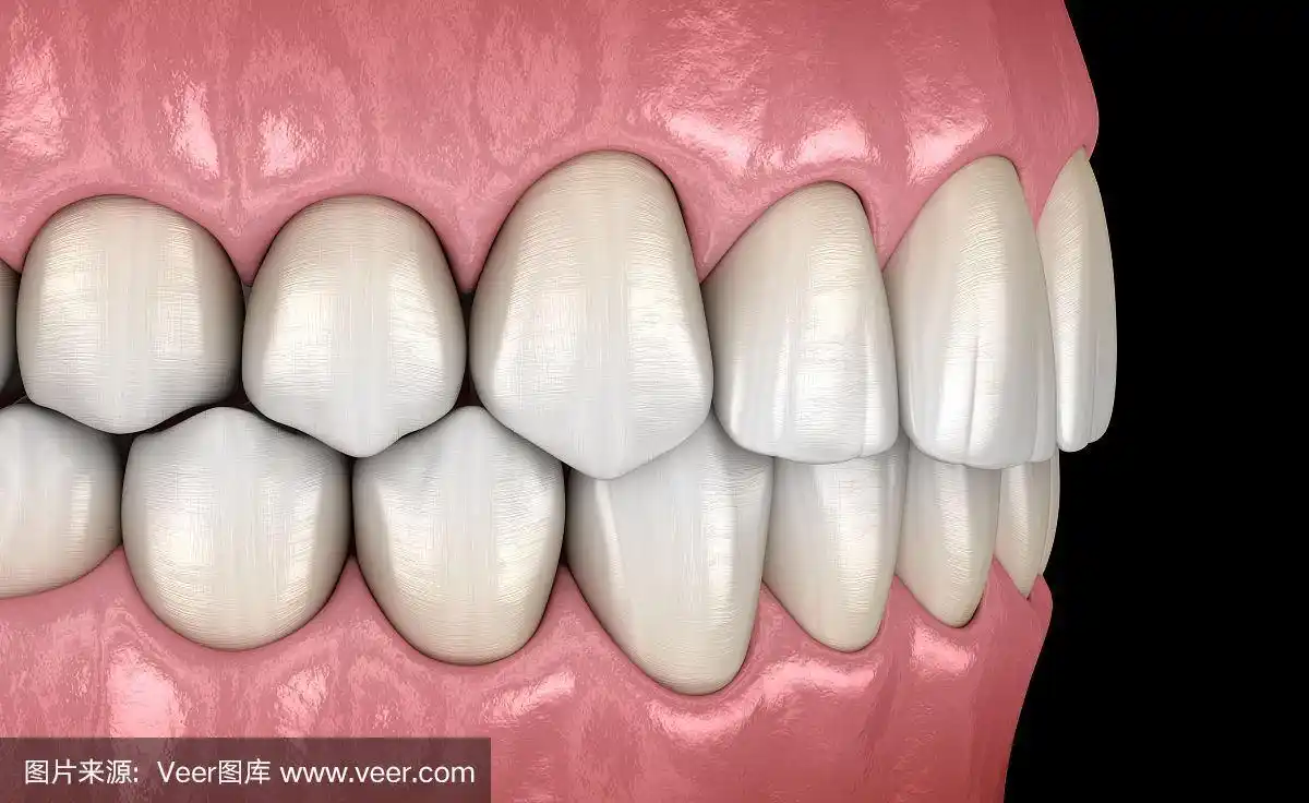 侧面图,正常咬合的健康人类牙齿.医学上准确的牙齿3d插图