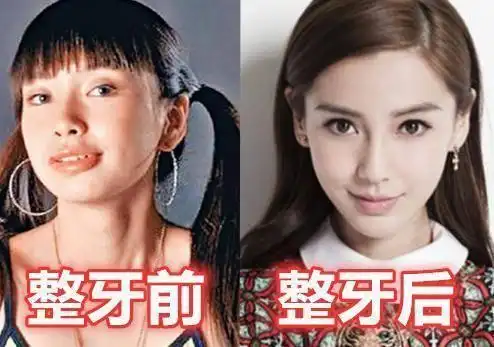 原创有种差距叫"明星整牙", 杨幂气质, 而她堪比"整容"