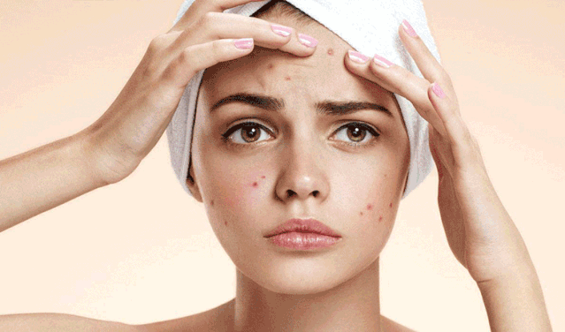 ps修图教程教你如何快速去除粉刺