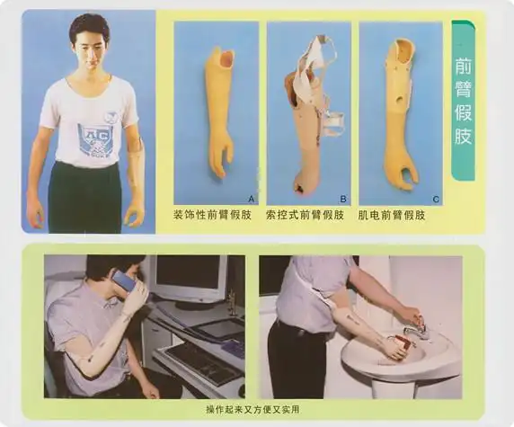 前臂假肢