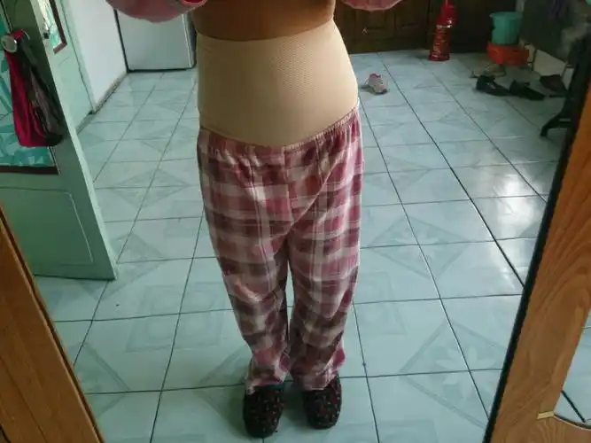 我是顺产  宝宝百天了  今天照镜子看到胯胯变形了右面  我该怎么办