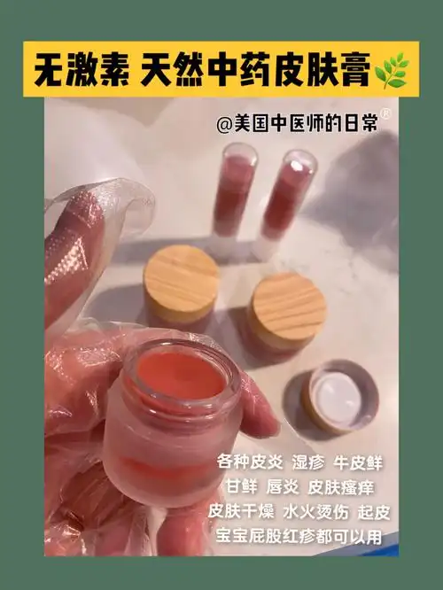 无激素天然皮肤膏终于做完了07