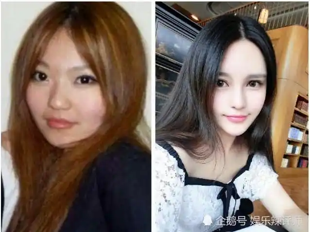 周扬青整容前vs整容后看到之前的照片网友差别也太大了吧
