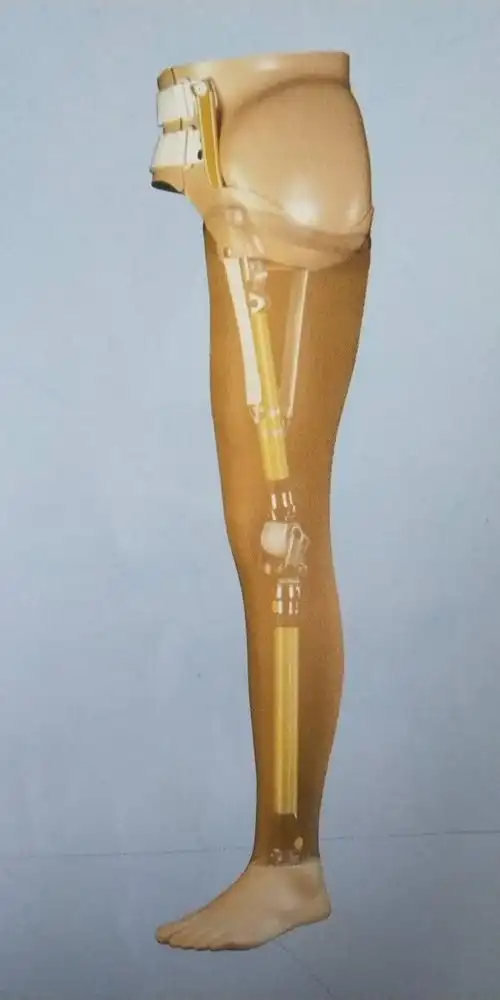 北京矫形器厂家,感应肌电手价格,北京肩离断假肢批发,电假肢价格,上肢