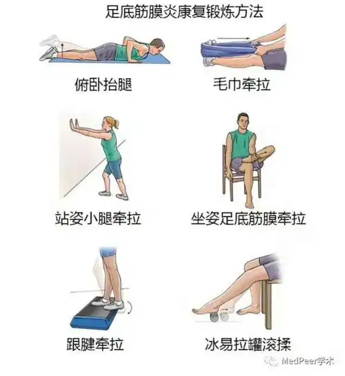 足底筋膜炎康复锻炼方法