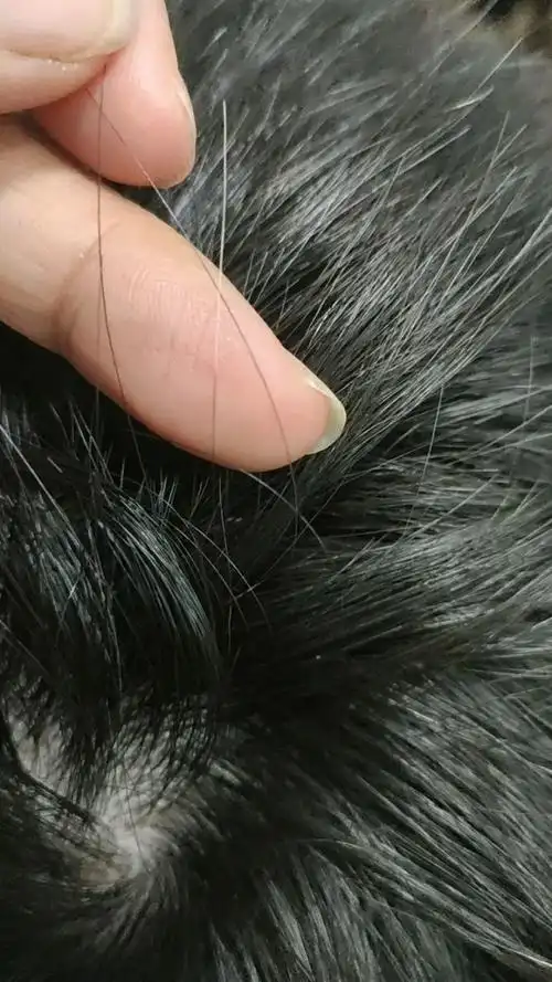 我儿子这根白发,真的由白转黑了!