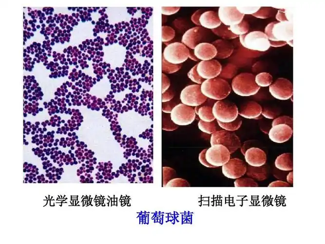 常见细菌对人的致病性. 光学显微镜油镜 扫描电子显微镜 葡萄球菌