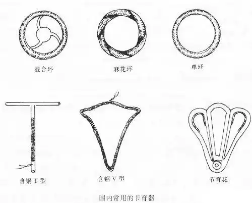 揭秘女性上环全过程,你被吓到了没撒