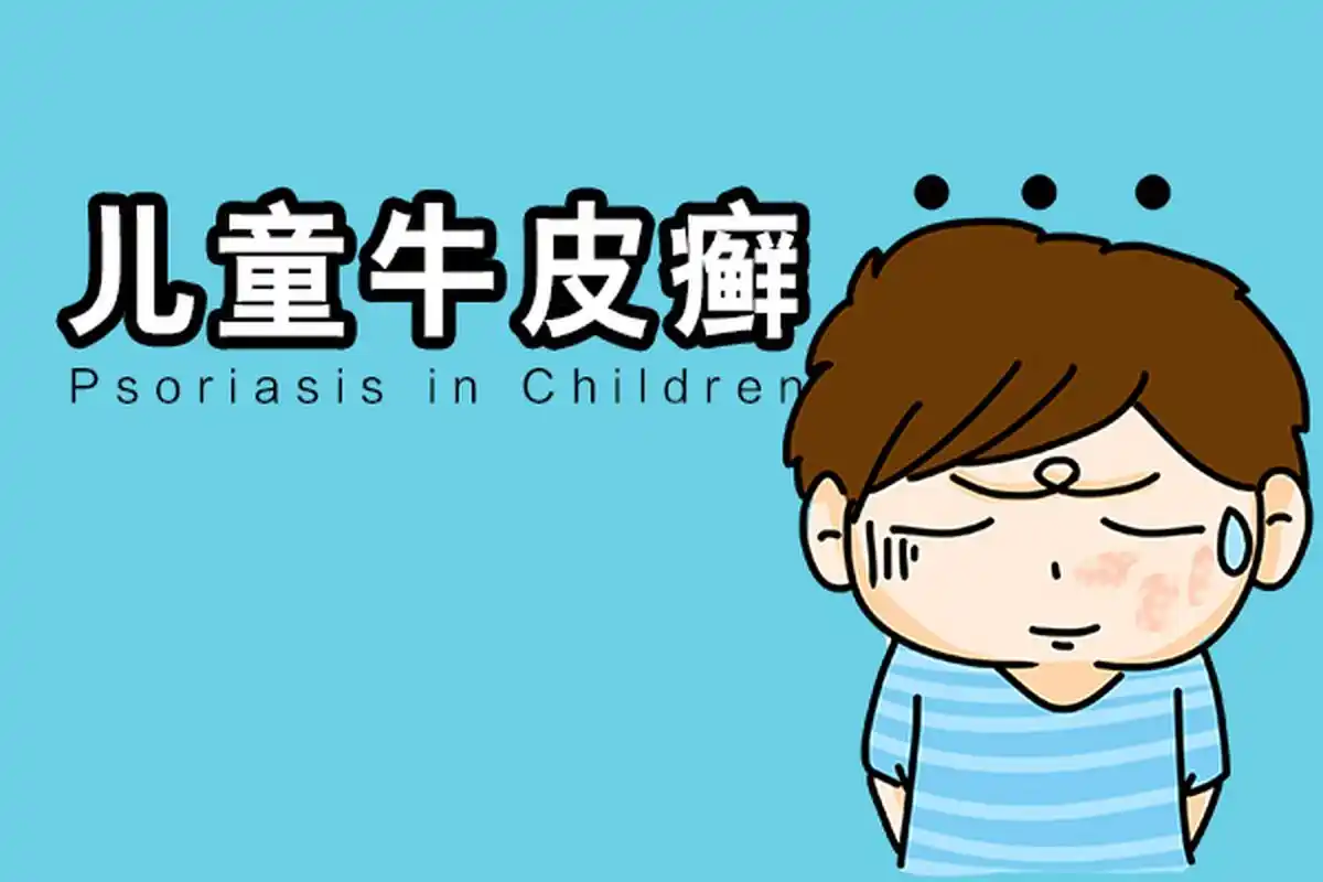 儿童银屑病,正确认识 尽早治疗很重要         我是皮肤科医生何英