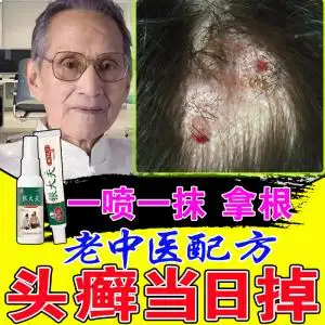 【头屑药膏】头屑药膏品牌,价格 - 阿里巴巴