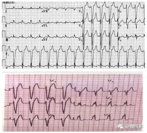 技能第一站2020执医技能心电图诊断技巧