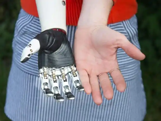 有许多不同的分类和名称,以下将经常使用的和比较先进的上肢假肢做一