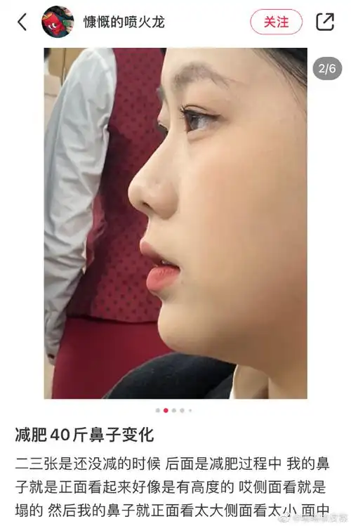 减肥40斤后鼻子的变化##夏日解忧放映会