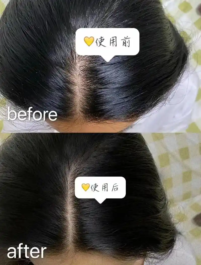 泰国生姜洗发水…防脱…生发…0差评…909090泰国 atr - 抖音