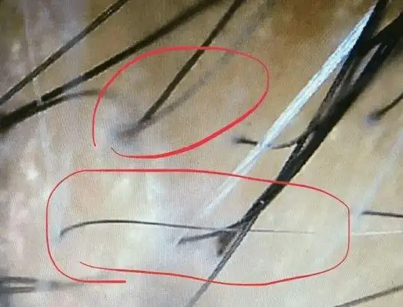 给发根喝营养液喷一喷就能养出油亮黑发别再用染发剂了