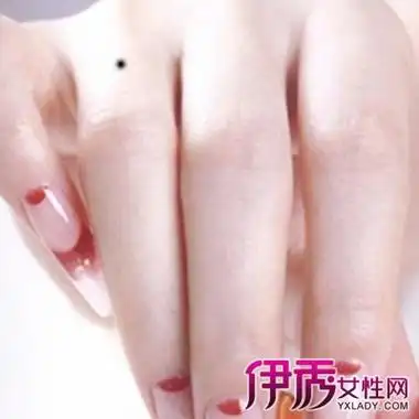 【图】左手手背上有痣图解展示 解析手掌志的含义