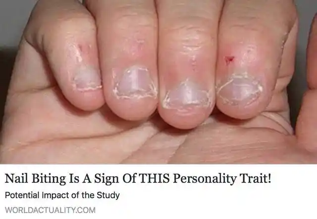 "咬指甲,原来是体现人体特征的最主要因素.