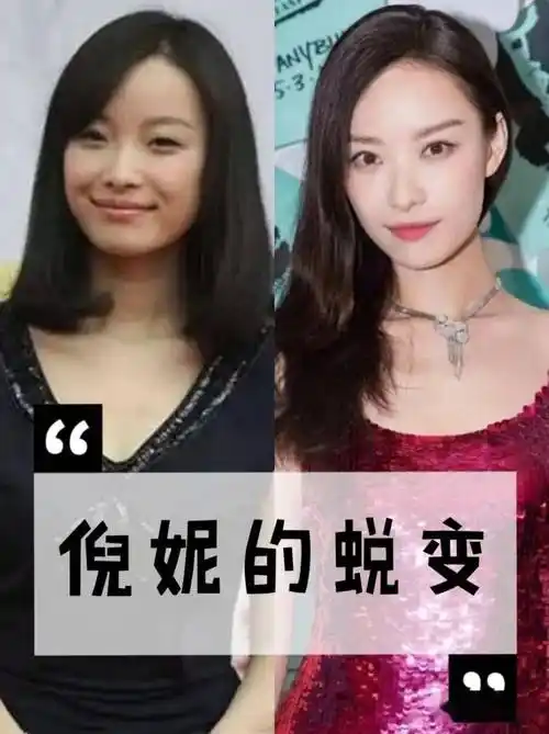 倪妮打了瘦脸针,整了双眼皮,还整了鼻子和下巴?