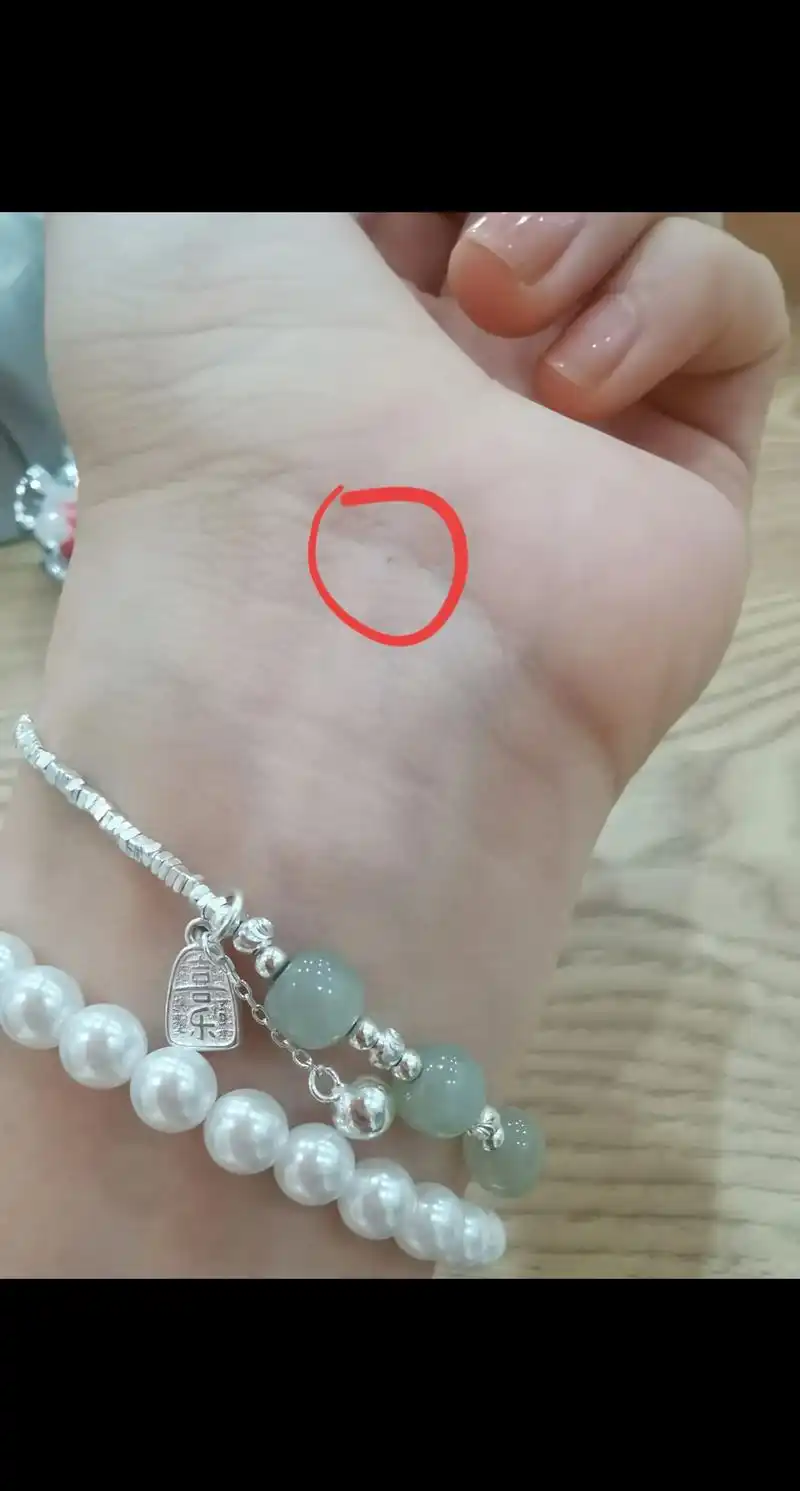 左手手腕正中间 今天发现长出一颗小痣,搜了一下说是:当你过了 - 抖音