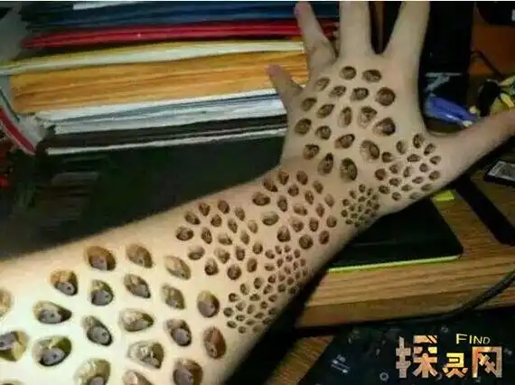 流传的一组照片,图片的手指上有一个洞,里面是空的,而且里面十分恶心