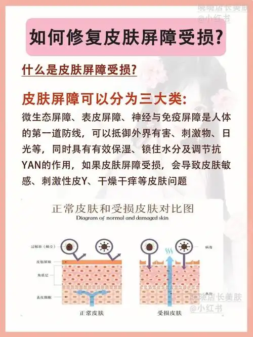皮肤屏障受损表现屏障受损该如何修复