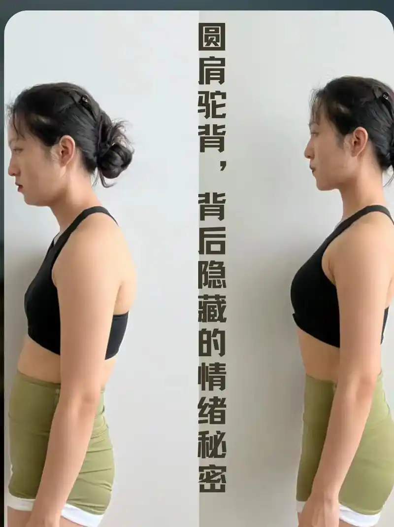 圆肩驼背颈前伸:体态提示你可能在被剥削.#体态调整 - 抖音
