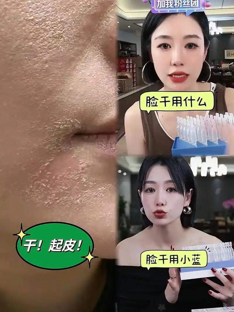 秋冬季,天气干燥,皮肤也容易干燥,护肤从补水保湿开始,姐妹们 - 抖音