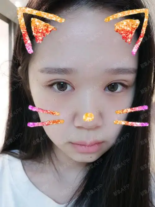 我眼角包太厉害了还是会有疤 会坚持擦药