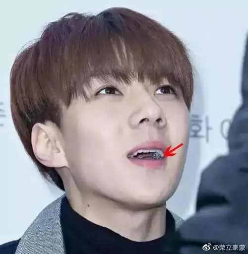 676767胡歌之前也觉得自己牙齿不好看,戴上了陶瓷牙套.