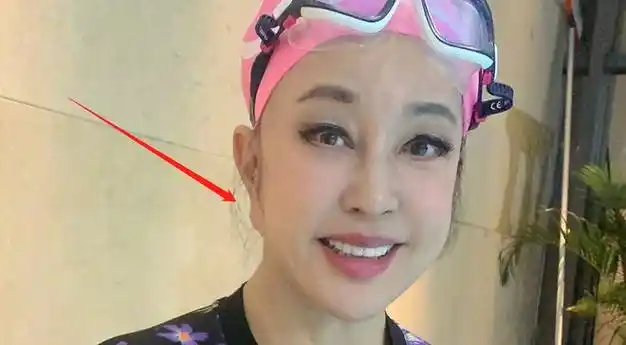 69岁刘晓庆晒游泳照耳朵因整容变形被拉长靠武则天捞金