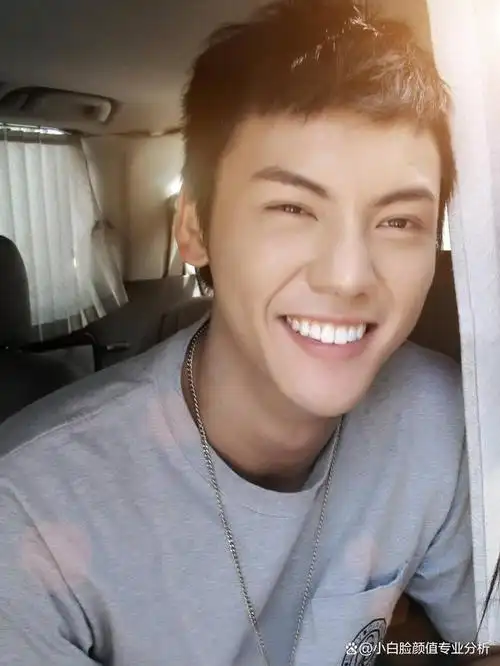 整形医生:坏坏的笑脸陈伟霆为什么越动态越好看,什么算男生女相