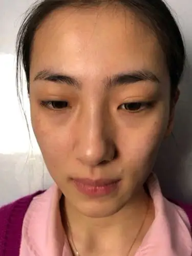 从小就比较黄是个正宗的黄皮肤人呢还被奶奶说我没她皮肤白嘤