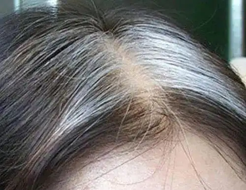 白头发拔一根长十根疑惑多年的事终于有答案了后悔知道的太晚