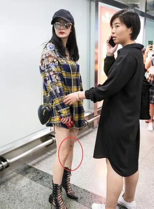 杨幂满腿是伤现身机场面对粉丝热情招呼却全程黑脸