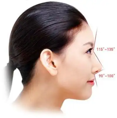 鼻梁低图 (11)_有来医生