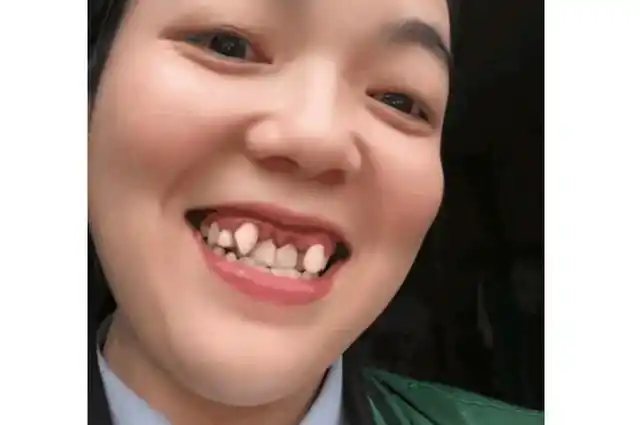 四川一位女子笑起来时露出虎牙,而画面却有点夸张,引来网友热议