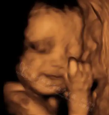 导读:研究表明,26周的胎儿就会做一些简单的表情,在杭州玛莉亚妇产