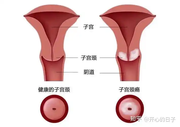 子宫最害怕的6件事90的女性逃不过第2件
