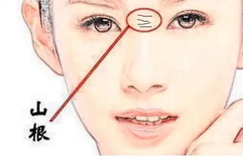 鼻子上有横纹的面相好不好需克服种种困难