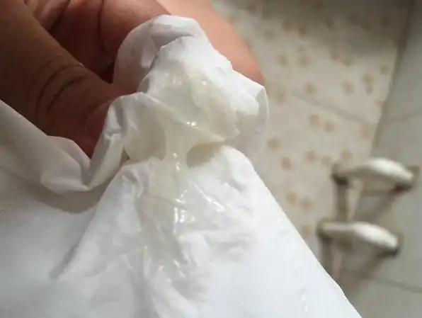 霉菌阴炎症状 (32)_有来医生