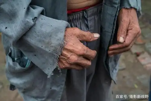 邵文有穿的衣服袖口很破