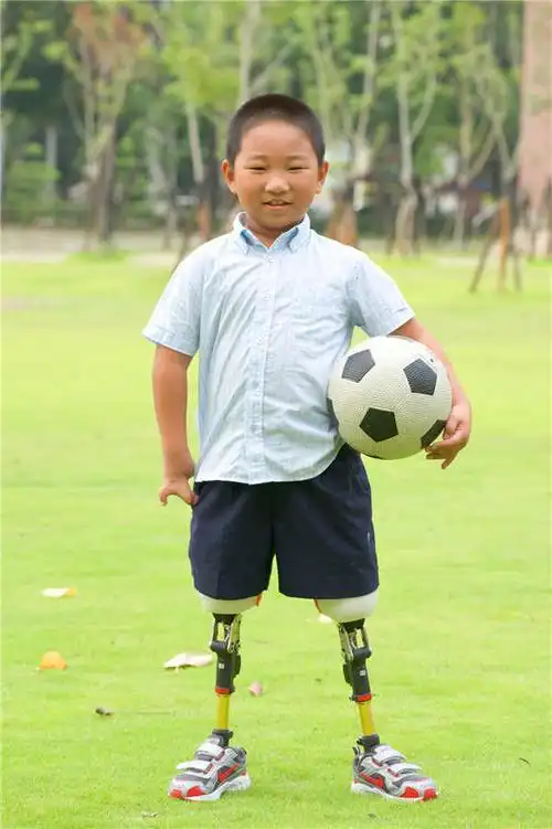 娄底小腿义肢报价儿童小腿假肢