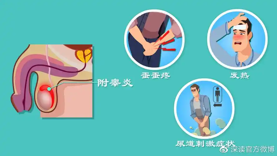 都有啥症状?如何检查该咋治?蛋蛋疼不但是个病,疼起来还要人命呢!"啥?